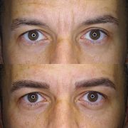 Diseño de cejas pelo a pelo con aspecto natural para hombres